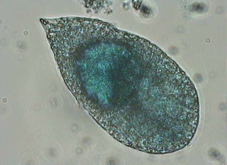 Dictyocha speculum
